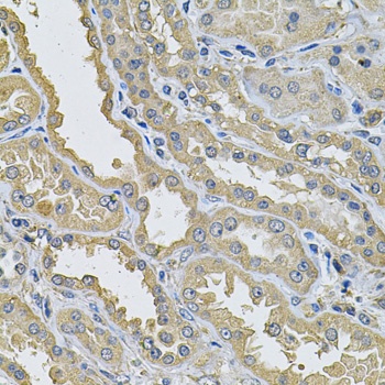 PPID Antibody