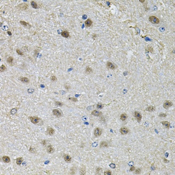 PPID Antibody