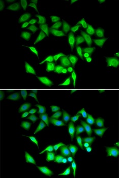 CCT3 Antibody