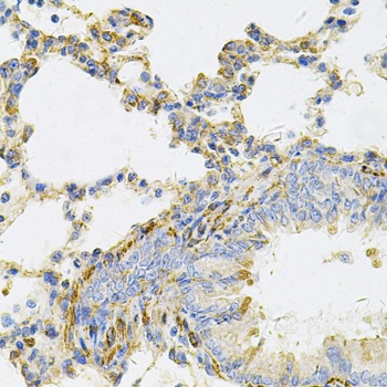 UBE2B Antibody