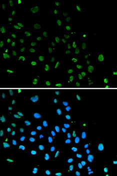 XRCC5 Antibody