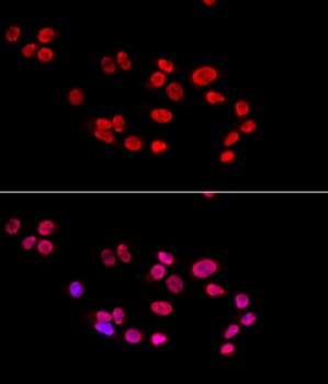 XRCC5 Antibody