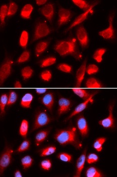 UROD Antibody