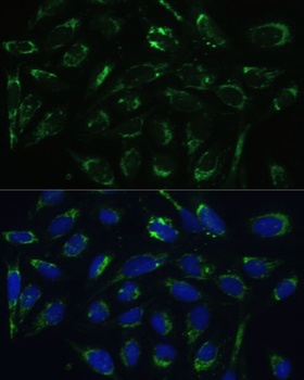 HSD17B10 Antibody