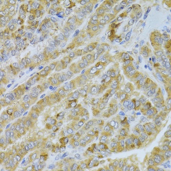 DLD Antibody