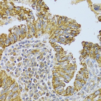 DLD Antibody