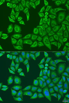 ABCF2 Antibody