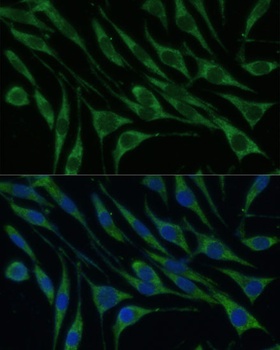 VARS Antibody