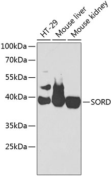 SORD Antibody