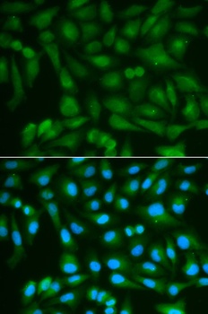 SORD Antibody