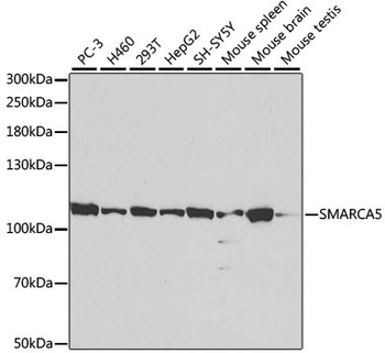 SMARCA5 Antibody