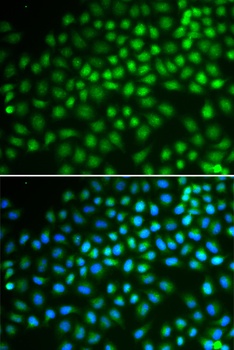SMARCA5 Antibody