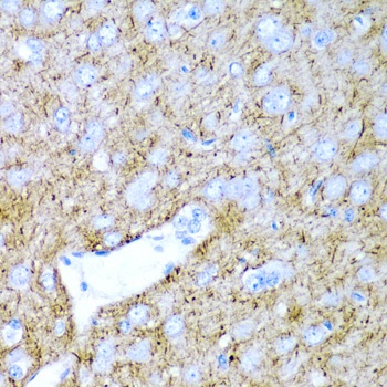 PTGDS Antibody