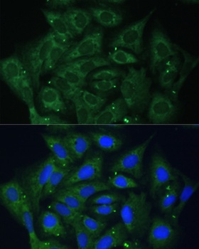 IGF2BP2 Antibody