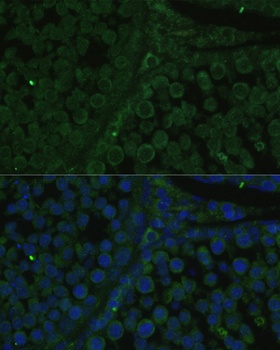 IGF2BP2 Antibody