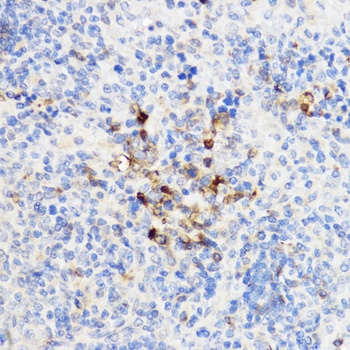 CHI3L1 Antibody