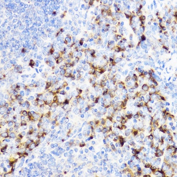 CHI3L1 Antibody