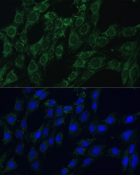 AEBP1 Antibody