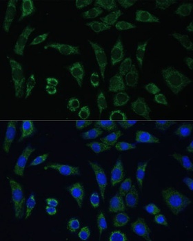 AEBP1 Antibody