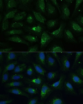 AEBP1 Antibody