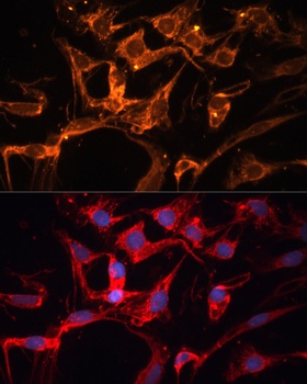 LPL Antibody