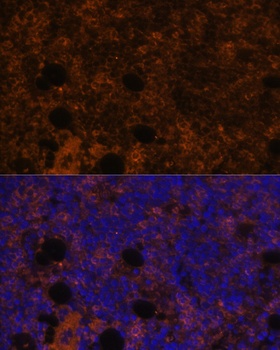 ITGAM Antibody