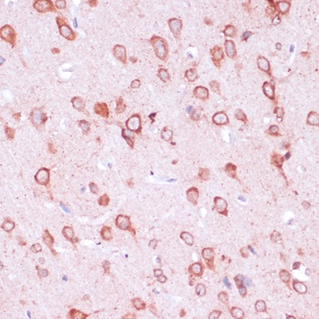 RPL21 Antibody