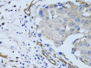 MCAM Antibody