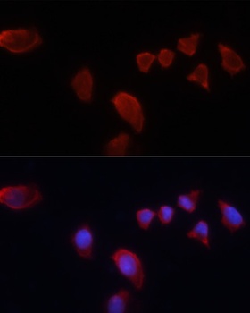 CA9 Antibody