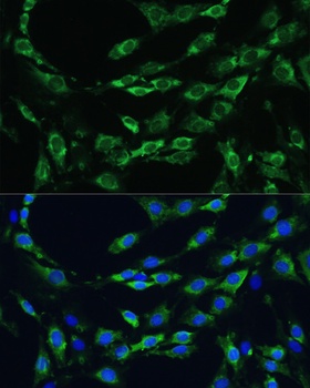 APOB Antibody