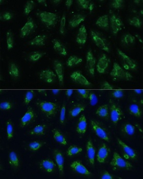 APOB Antibody