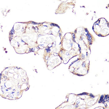 IGF2R Antibody