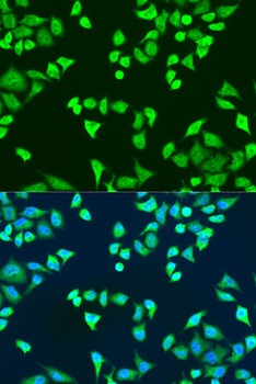 SMN2 Antibody