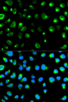 GYPC Antibody