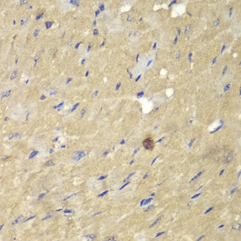 AKR7A2 Antibody