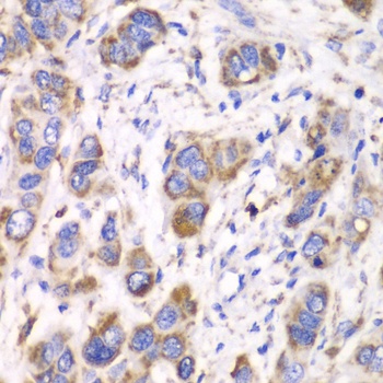 ALDH2 Antibody