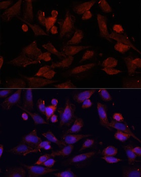 GPER1 Antibody