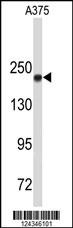 TOP2A Antibody