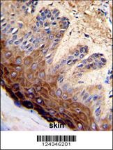 TOP2A Antibody