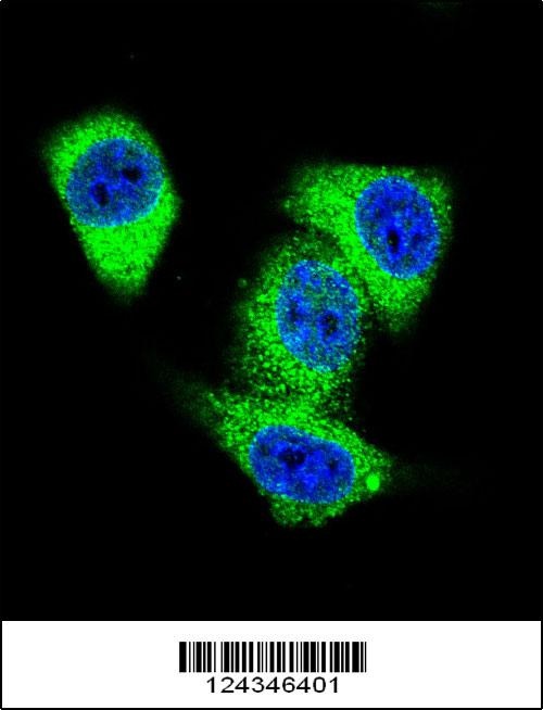 TOP2A Antibody