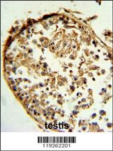 CTSS Antibody