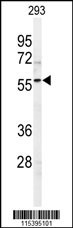 SPHK1 Antibody