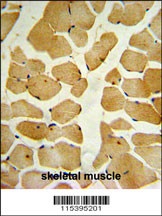 SPHK1 Antibody