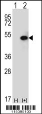 SPHK1 Antibody
