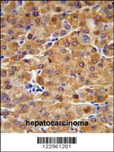 CBS Antibody