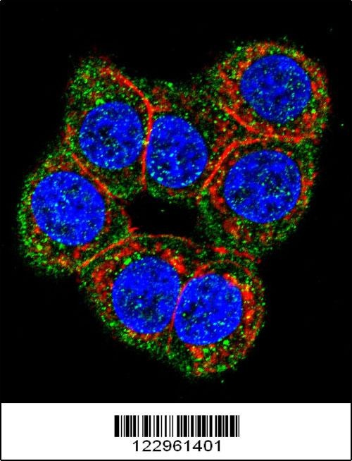 CBS Antibody