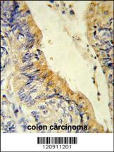 ACADM Antibody