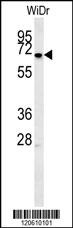 MEIS2 Antibody