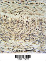 DDX23 Antibody