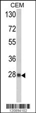 PRDX6 Antibody